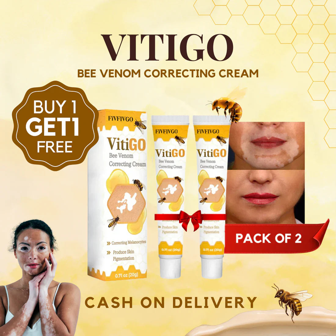 VitiGO™ Revitalizing Bee Venom Cream – Natural Skin Restoration & Vitality 🐝✨ (Buy 1 Get 1 Free🔥)